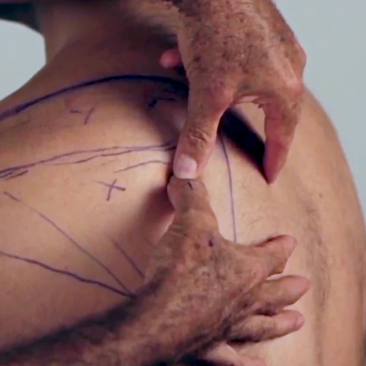 NAT Treating the Rotator Cuff (4 CEUs)