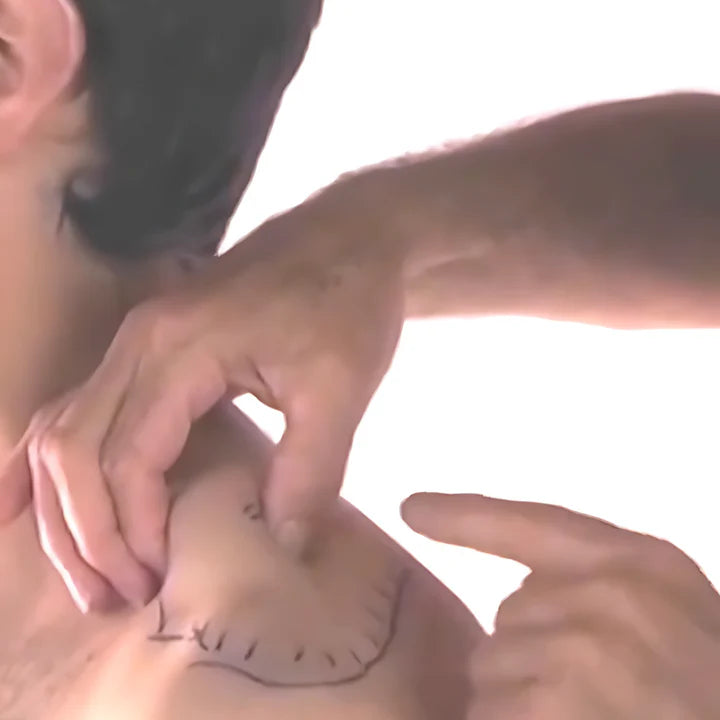 Tension Headache and Trigger Points (4 CEUs)