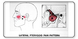 The Myofree Solution