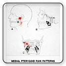 The Myofree Solution