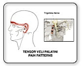 The Myofree Solution